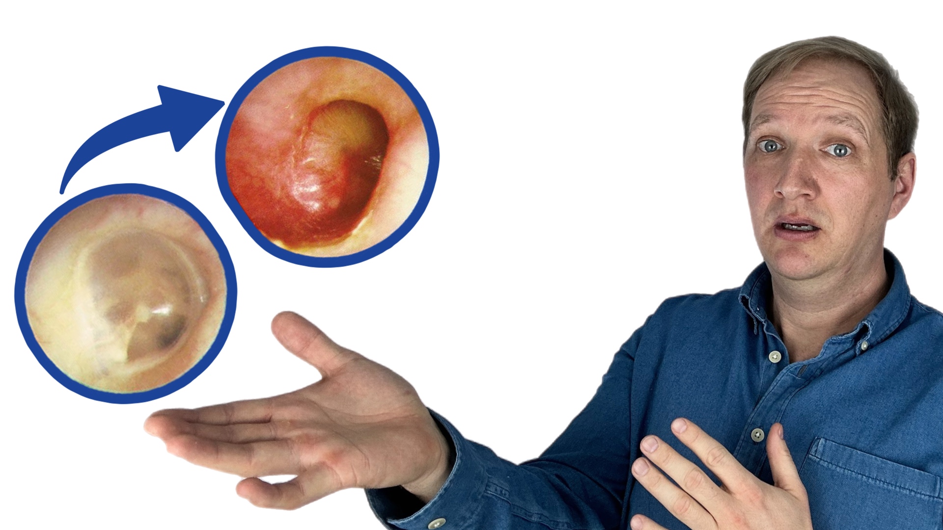 Bild zeigt erstaunten Mann der zwei Trommelfelle sieht. Ein schönes, normales Trommelfell und ein gerötetes